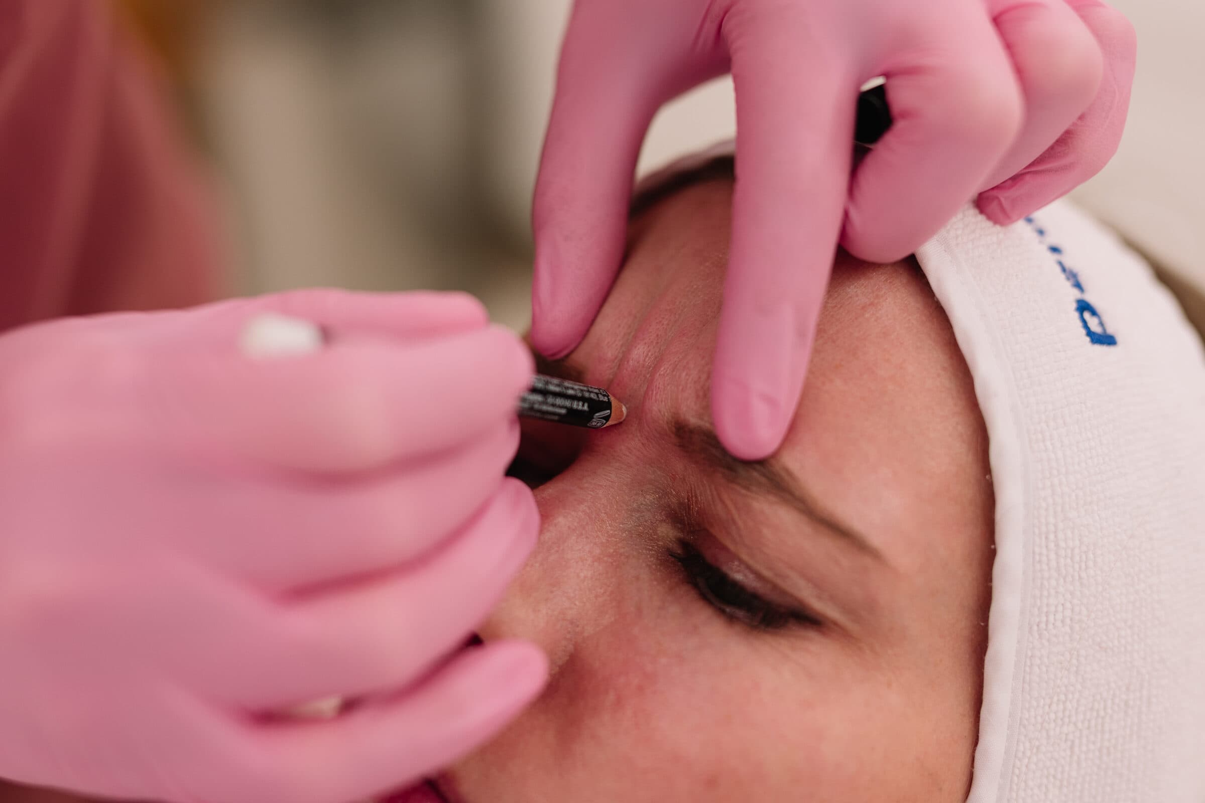 Dermal fillers at Vere Dental