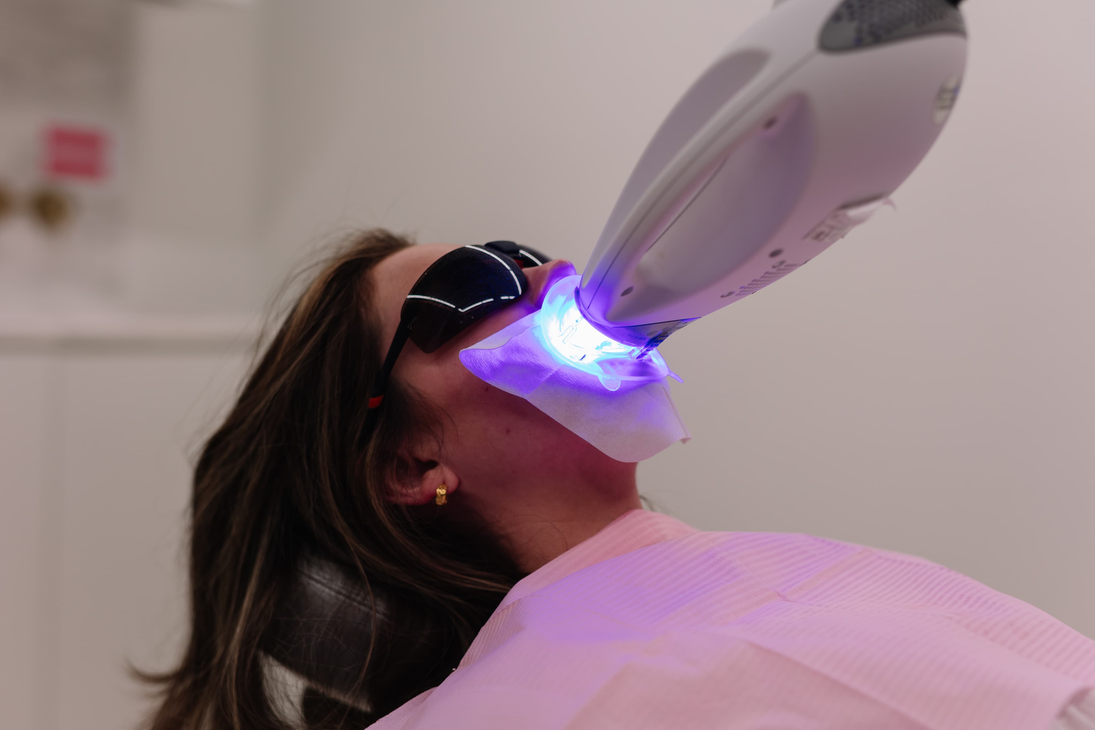 Teeth whitening treatment at Vere Dental